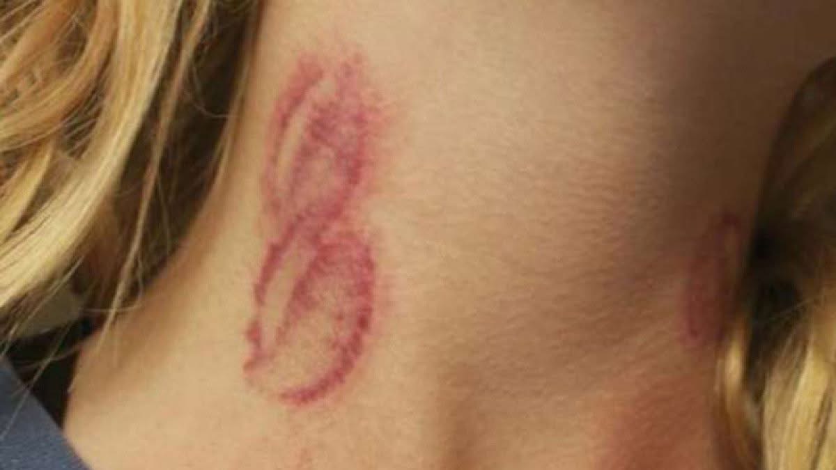 लभ बाइट्सका रोमाञ्चक पक्ष